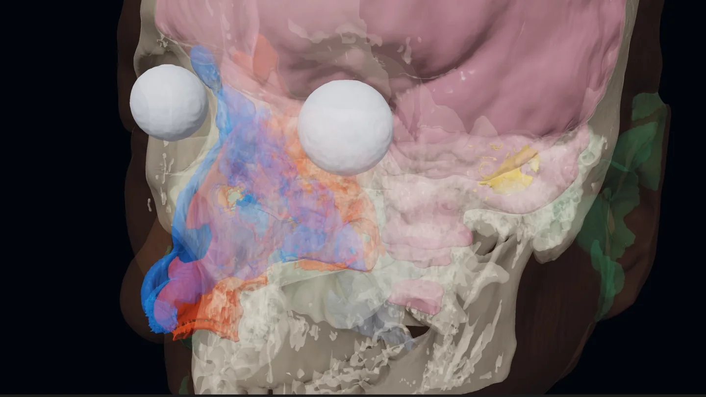 Transparent head reconstruction revealing the skull, eyes, brain and nasal anatomy