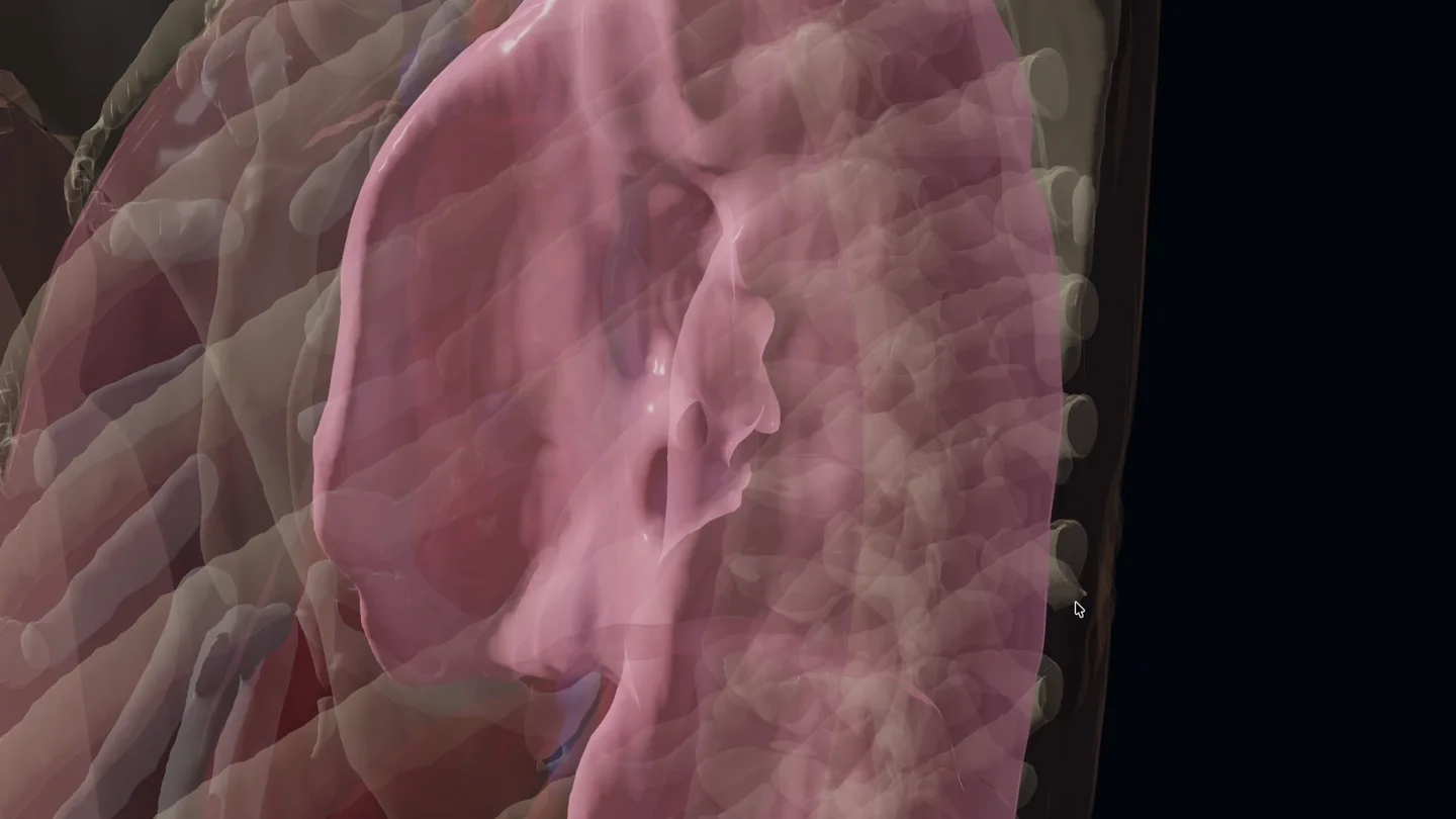 Reconstructed lungs with the rib cage visible around them